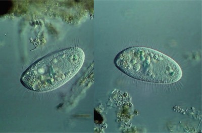 Pleuronema sp.  40x DIC