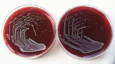 Propionibacterium-acnes.jpg